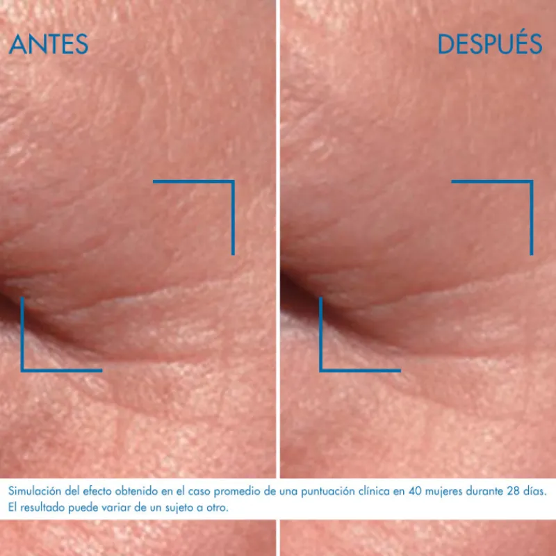 Best BLUE PRO-RETINOL OJOS Arrugas|Ojos & Labios